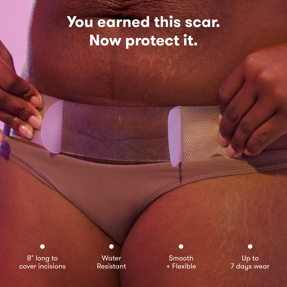 C-Section Silicone Scar Patches